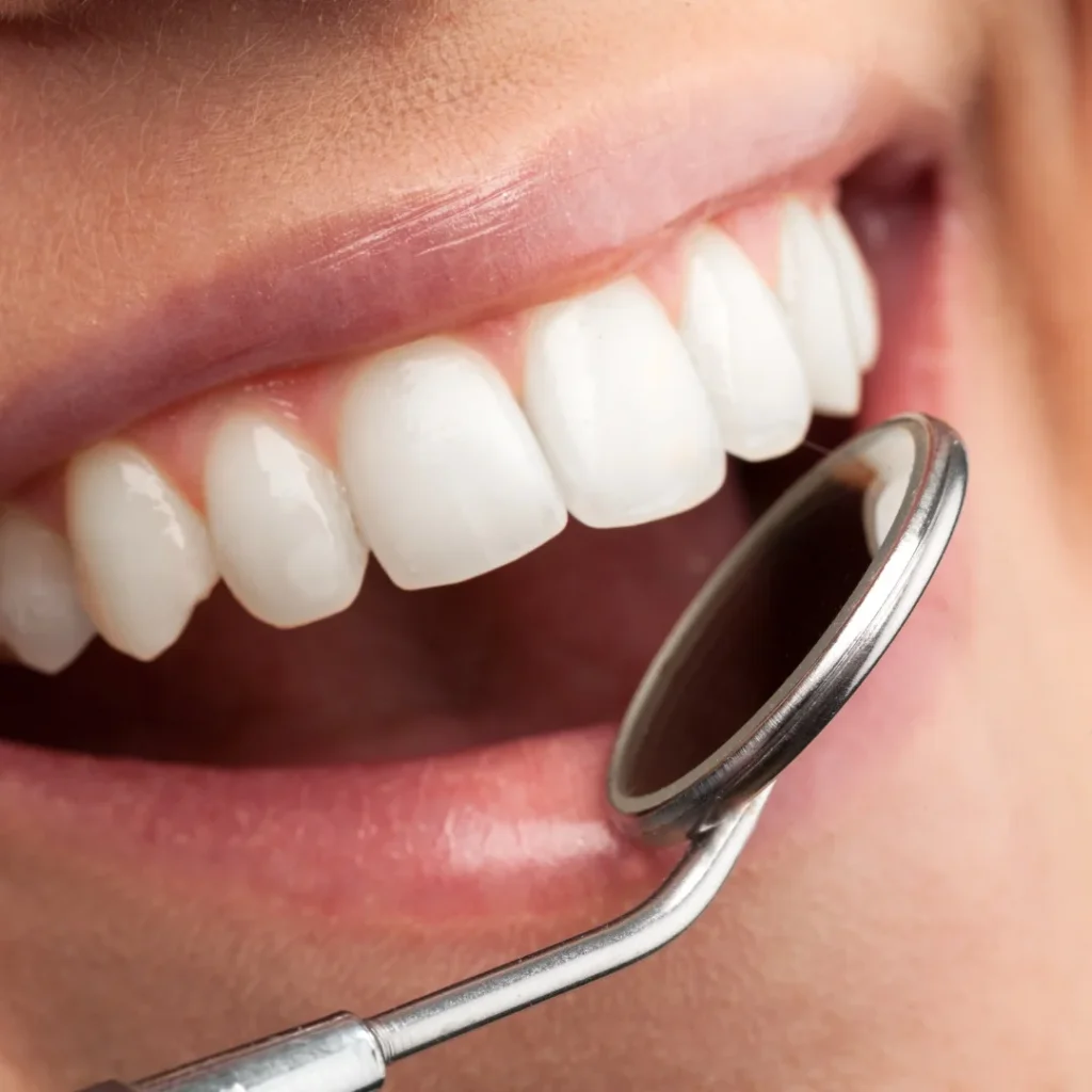 Endodoncia - Tratamientos de Conducto