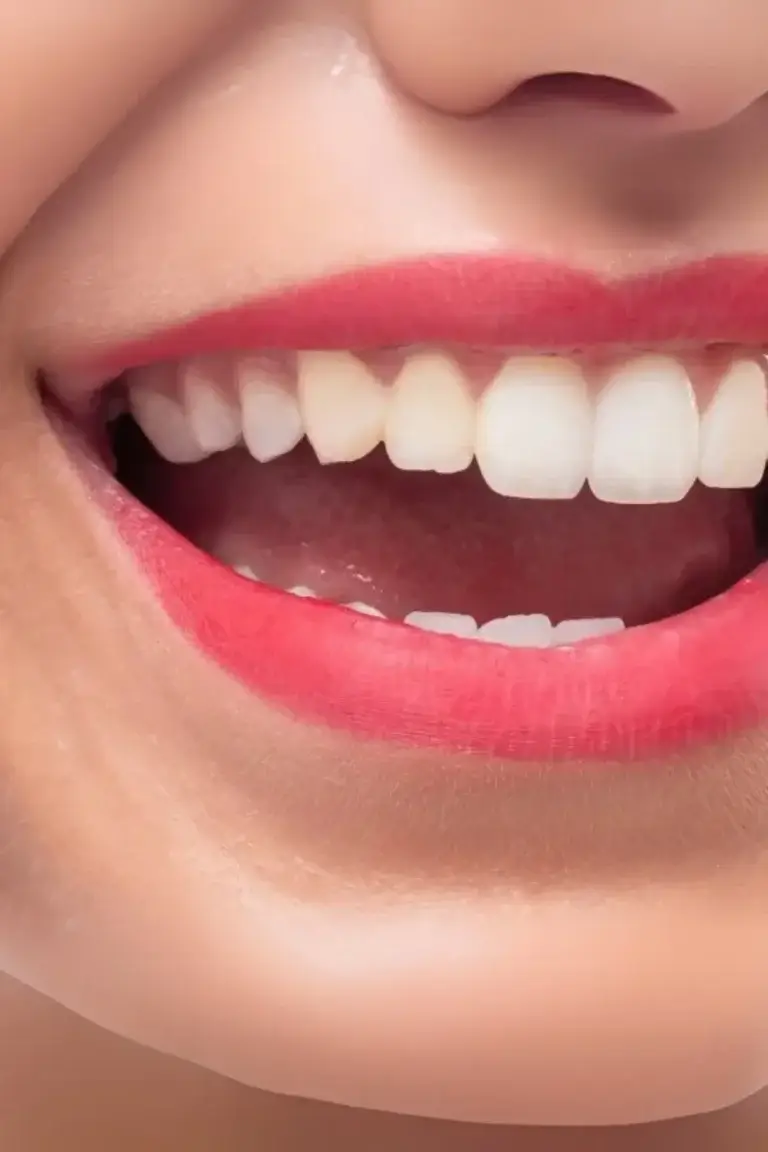 Preguntas frecuentes tratamiento dental